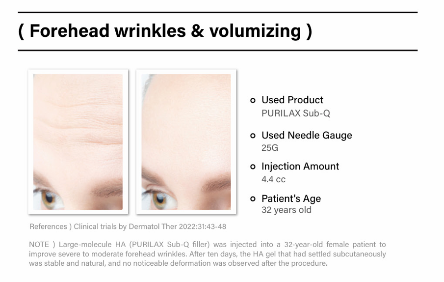 Purilax with Lidocaine